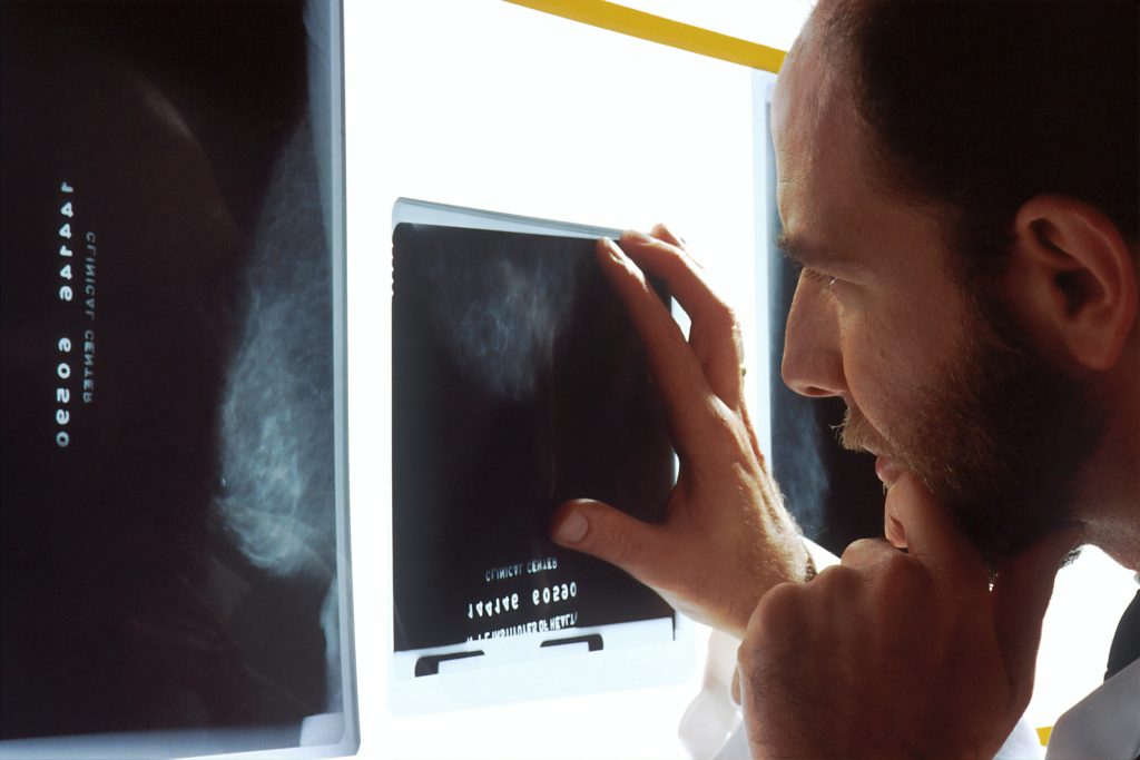 CBD Olja och Cancer - Vad säger forskningen?
